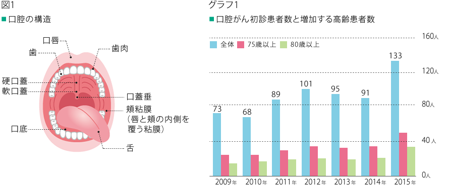 口腔を構成するものは、歯、顎骨とそれらを覆う粘膜があり、口唇、頬粘膜、歯肉、舌、口底、口蓋があります。口腔がんは近年、増加傾向にあり、社会の高齢化に伴って高齢の患者さんが増えています。この傾向は、恵佑会札幌病院でも明らかです。